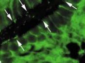 DIAGNOSTIC: Vous avez ulcère? Votre estomac devient vert! PLoS