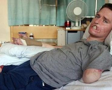 ALERTE INFO. Santé: une étrange bactérie mangeuse de chair vient d’apparaître