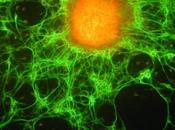 Curcumine Cellules souches cancer