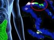 DIABÈTE type Eduquer cellules intestinales produire l'insuline Nature Communications