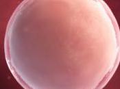 Première NAISSANCE partir tissu ovarien pré-pubère congelé Human Reproduction
