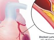 #trendsinendocrinologyandmetabolism #AMPK #ischémiecardiaque: capteur d’énergie mécanisme survie cœur lors d’une ischémie
