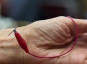 HYPERTENSION (HTA): l'on essayait l'acupuncture Medical Acupuncture