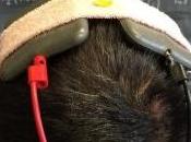 PARKINSON: Nouvelle preuve l'efficacité stimulation cérébrale externe Journal Neuroscience
