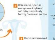 GREFFE l'UTÉRUS: vert pour l'essai clinique français Réseau