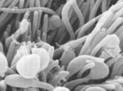 IST: Mycoplasma genitalium, infection urinaire génitale silencieuse International Journal Epidemiology