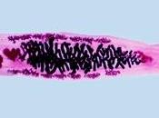 PLAIES CHRONIQUES: parasite cancérigène booste cicatrisation PLOS Pathogens