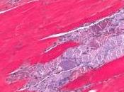 SANTÉ MUSCULAIRE: préserver avec l'âge bloquant myostatine Lancet Diabetes Endocrinology