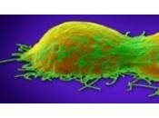 CANCER l'OVAIRE: nouveau facteur génétique identifié Journal National Cancer Institute