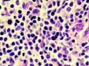 CANCER PEAU: Quand bactéries prêtent main forte cellules cancéreuses Blood