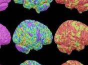 NEURO: Génétique environnement affectent différentes zones cerveau Journal Nuclear Medicine