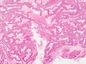 MICROBIOME: bactéries nocives cachées dans liquide séminal Scientific Reports