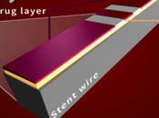 [Portrait d'innovateur] Franz Bozsak hacke artères pour meilleur traitement