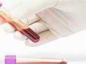 TRAUMA CÉRÉBRAL: L'évaluer simple test sanguin JAMA