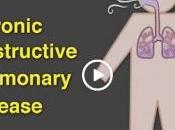 TABAGISME: Toux fumeur vrais symptômes maladie pulmonaire obstructive chronique? NEJM