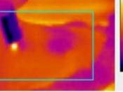 PLAIES SUPERFICIELLES: bleue pour mieux photocoaguler Journal Biophotonics