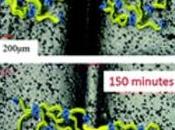 SOIN PLAIES: plastique magique réduit changements pansements Journal Chemical Sciences