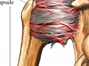 Mesotherapie capsulite