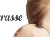 bronzage peau grasse