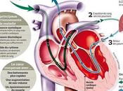 #thelancetrespiratorymedicine #insuffisancecardiaque #fractiond’éjection #ventilationassistée Mécanismes sous-jacents liés risque augmenté mortalité chez patients atteints d’insuffisance cardiaque fraction d’éjection réduite assignés ha...