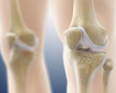 ARTHROSE: Un hydrogel intelligent pour régénérer le cartilage abîmé – Santé Orthopédique