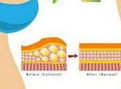 astuce pour maigrir rapidement ventre