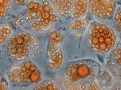OBÉSITÉ: Graisse blanche, graisse brune, n'est qu'une question couleur! Cell Reports