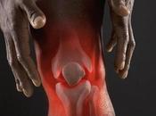 ARTHROSE GENOU: L’efficacité l’injection d’acide hyaluronique? Santé Orthopédique