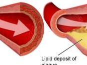RISQUE CARDIAQUE: Pourquoi quelques grammes graisses saturées font différence