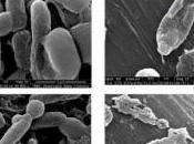 CICATRISATION plaies Électrocuter biofilm pour l'éliminer Biofilms Microbiomes