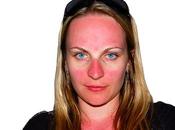 bronzage peau rouge