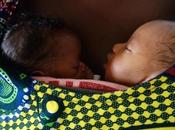 PRÉMATURITÉ bébés Kangourou sont toujours plus forts Pediatrics
