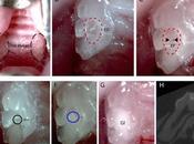 CARIE DENTAIRE L'anti-Alzheimer protège pulpe régénère dentine Scientific Reports