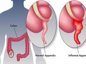 APPENDICITE chez l'ENFANT Sauf complications, antibiotiques wait Lancet Gastroenterology Hepatology