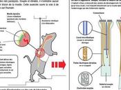 implant progresse dans lutte contre paralysie