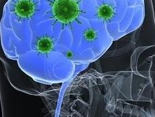 SYNDROME CÔLON IRRITABLE cerveau cause dans déséquilibre microbiote Microbiome