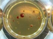 ANTIBIORÉSISTANCE microbes mutants solitaires