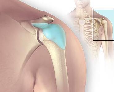 La bursite : causes, symptômes et traitement