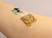 PLAIES CHRONIQUES temps pansements intelligents