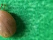 Maladie LYME menace croissante tiques appelle réponse Santé publique