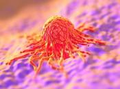CANCER PANCRÉAS composé affame cellules cancéreuses