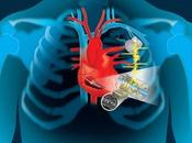 INSUFFISANCE CARDIAQUE Recycler l'énergie cœur pour alimenter stimulateur