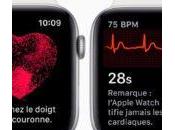 Apple Watch l’électrocardiogramme enfin disponible watchOS