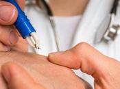 TIQUE Piqûre allergie viande rouge, risque plus élevé prévu