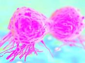 CANCER SEIN TRIPLE-NÉGATIF reste couper vivres