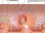 CANCER COLORECTAL détecte dans microbiote intestinal