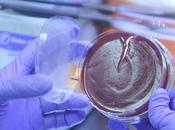 MICROBIOTE manipulation pourrait suffire bloquer tumeurs