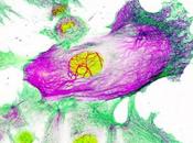 CANCER CERVEAU nanocapsule thérapeutique passe barrière hémato-encéphalique