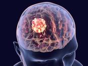 ARTHRITE Agir directement cerveau pour bloquer douleur