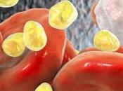 ATHÉROSCLÉROSE nanoparticules restent côté plaque